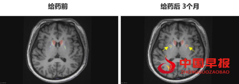 1759133225156848.png 2_副本.png